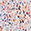 Speckled Sunrise Sweater